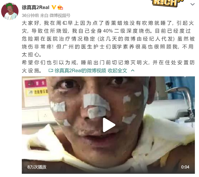 歌手徐真真因家中失火遭二级深度烧伤，曾参加《中国有嘻哈》
